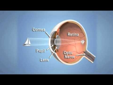 eye clinics dubai