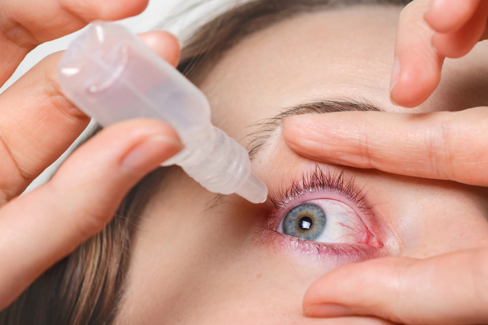 dry eye treatment simple