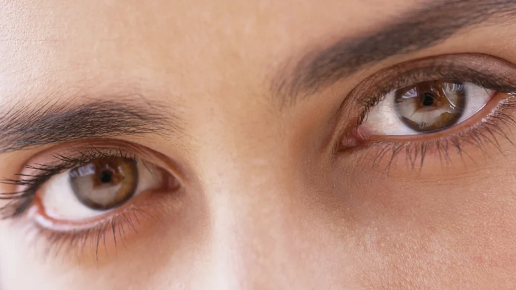 lazy eye treatment dubai