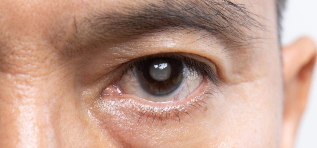 الشبكية وامراض العيون