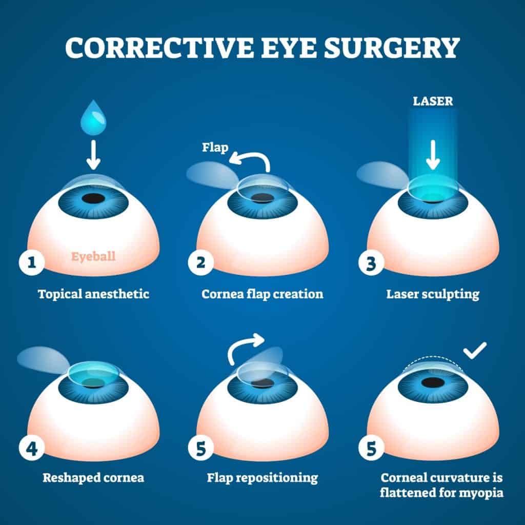 vision correction 
